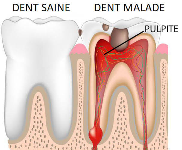 LYRA Dental